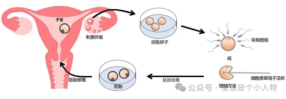 试管婴儿, 胚胎培养, 卵子采集